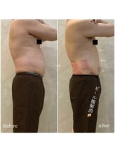 OBS新潟整骨院/OBSは男性人気も圧倒的NO、1