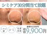 【シミケア★30分当て放題】高濃度ビタミン導入ヘッド＆デコルテマッサージ付