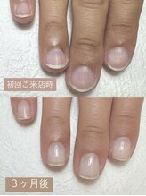 レティ(Letty)/自爪育成♪３ヶ月での変化