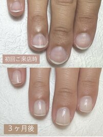 自爪育成♪３ヶ月での変化
