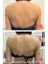 ラン(Ran)/背中美人へ変身♪