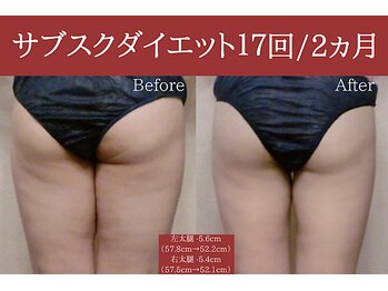 空 荻窪(くう)/足のむくみ脂肪はスリムボディで