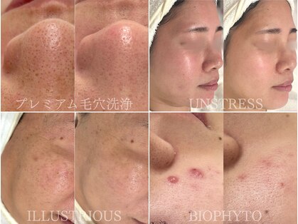 ジェム(gemme)の写真