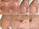 ジェム(gemme)の写真