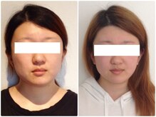 美容整体 ウェリナ 蟹江院/小顔矯正/骨盤矯正/美脚サロン