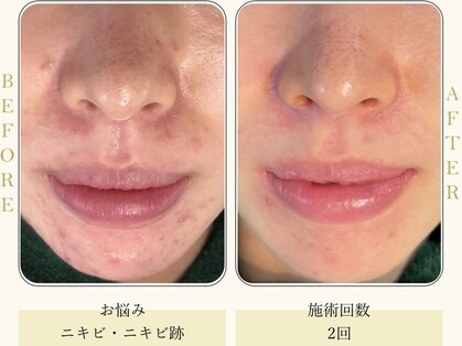 サロンアン(Salon an)の写真