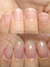 マリーロール 梅田店(Marie Laure)/深爪矯正/自爪育成/ネイルケア