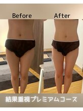 ヨサパーク ミュー(YOSA PARK Mieux)/Before After