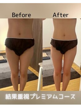 ヨサパーク ミュー(YOSA PARK Mieux)/Before After