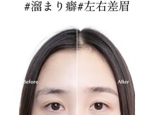ユー(u.)の雰囲気(眉毛の悩みは全て生え癖が原因かも?その癖改善してみませんか?)