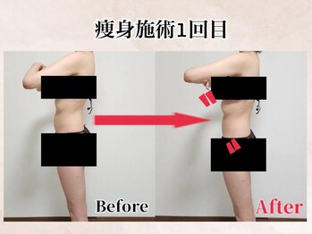 エヌ(N)の写真/自分磨きを楽しむ場所♪通いたい放題プラン有り。気になる箇所のみ部分施術も◎で満足