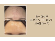 リシア(RECIA)