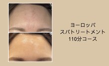 リシア(RECIA)