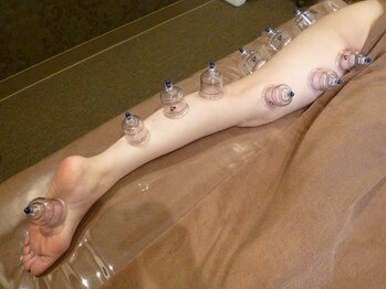 セラヴィ 元吉田店/吸引