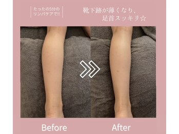 スイートヴィラズ 北堀江店(SWEET VILLAS)/リンパケアで理想のお身体へ