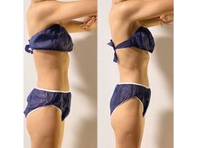 ベリッシマ筋膜セラピー/姿勢が良くなると