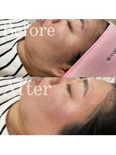 ファミーユ 太田(Fameu)/フェイシャルWax