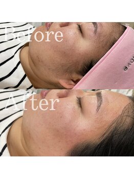 ファミーユ 太田(Fameu)/フェイシャルWax