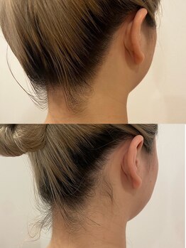 ミルズ(MillS)/うなじシェービング