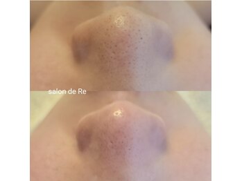 サロンドリー(salon de Re)/超音波エクストラクション