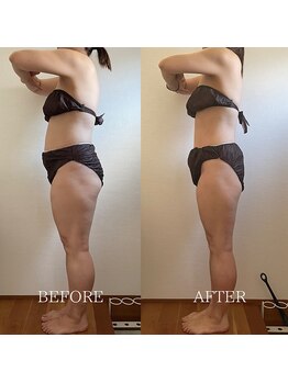 ブルーム(BLOOM)/痩身プログラム3ヶ月　-10kg