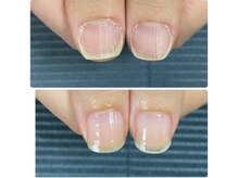 ルカロンネイル(Rukaron Nail)/間違ったカットの仕方