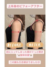 ブルーミングデイズ(blooming days)/上半身矯正