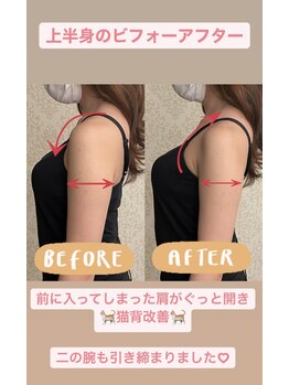 ブルーミングデイズ(blooming days)/上半身矯正