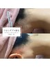 【うなじダブル脱毛】うなじWAX+うなじ光脱毛　¥6500→¥5000