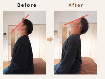 ハリデイズ/40代-肩首の痛み、背中のハリ