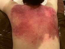 エステティックサロン エン(en)/--エステティックサロン en--