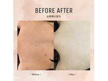 ルミエールブランシュ(Lumiere blanche)の雰囲気（《最速でつるスベ美肌》全身脱毛が人気☆）