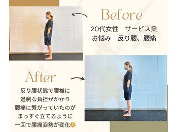 アクイラ せんげん台(AQUILA)/姿勢矯正の変化