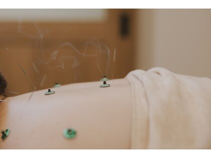 フュー(few.)の写真