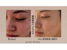 ジェルム(germe.)/★定番人気NO.1メニュー★