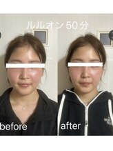 ヨサパーク メンソーレ(YOSA PARK)/Before after の撮影