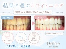 ドルチェ(Dolce)