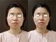 セラピアの写真/コルギで叶える理想の小顔へ！リフトアップで左右差もケア◎小顔矯正で自信あふれるフェイスラインを☆