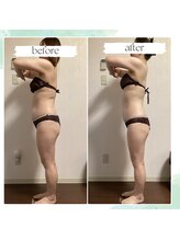 エソール(essor)/痩身マッサージでダイエット