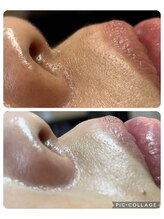 ラピス(Lapis)/理容師によるツヤ肌シェービング