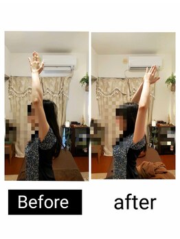 アース エンジェル整体院/ビフォアフ　肩こり　ストレッチ