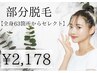 【部分脱毛】全身63部位(顔VIO含む)からセレクト!!◆1箇所◆￥2,178