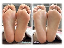 ヴィーナ(VEAN)の雰囲気（角質ケアでふわふわカカトに♪フットジェルとセットもオススメ◎）