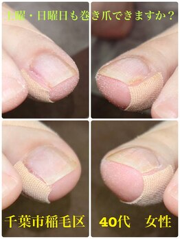 巻き爪じゅん 船橋店/土曜・日曜日も巻き爪できる？