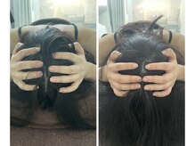 ブルーミングデイズ(blooming days)/ヘッド矯正。頭蓋骨矯正