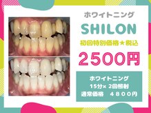 シロン(SHILON)