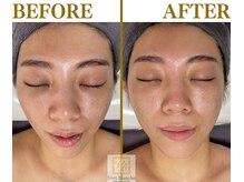 ヴェールブランシュ 町田(Vert Blanche)/#ブライダルエステ#フェイシャル