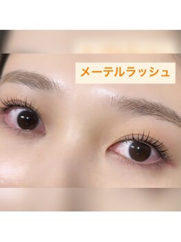 フロラ(Flora)/◇メーテルラッシュ