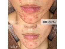 スイ(Suui.)の雰囲気（一度の施術でも効果実感）