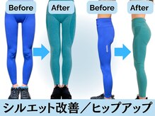 脚のシルエット改善、ヒップアップで理想の美脚に☆